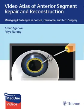 Agarwal / Narang |  Video Atlas of Anterior Segment Repair and Reconstruction | eBook | Sack Fachmedien