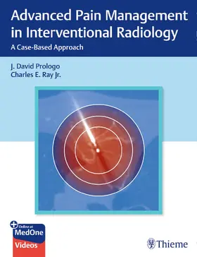 Prologo / Ray | Advanced Pain Management in Interventional Radiology | E-Book | sack.de