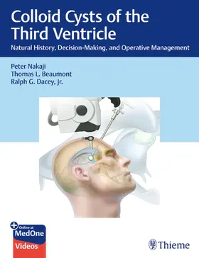 Nakaji / Beaumont / Dacey, Jr. |  Colloid Cysts of the Third Ventricle | eBook | Sack Fachmedien