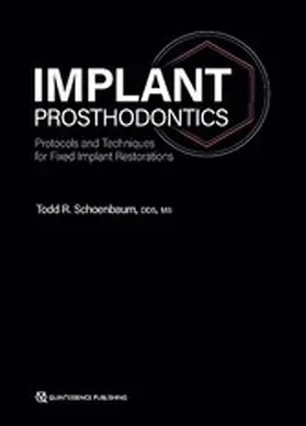 Schoenbaum |  Implant Prosthodontics | eBook | Sack Fachmedien