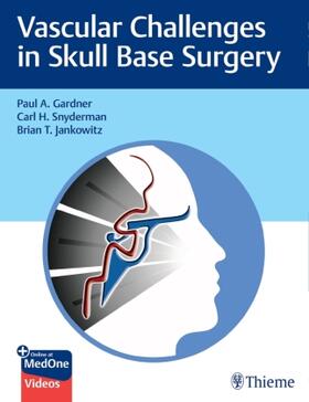 Gardner / Snyderman / Jankowitz |  Vascular Challenges in Skull Base Surgery | Buch |  Sack Fachmedien