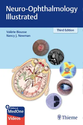 Biousse / Newman |  Neuro-Ophthalmology Illustrated | Buch |  Sack Fachmedien