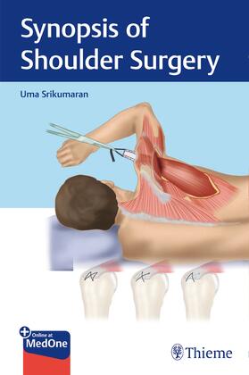 Srikumaran | Synopsis of Shoulder Surgery | Medienkombination | 978-1-68420-080-1 | sack.de