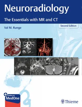 Runge |  Neuroradiology | Buch |  Sack Fachmedien