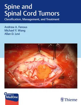 Fanous / Manzano / Wang |  Spine and Spinal Cord Tumors | Buch |  Sack Fachmedien