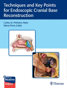 Pinheiro-Neto / Peris-Celda |  Techniques and Key Points for Endoscopic Cranial Base Reconstruction | Buch |  Sack Fachmedien