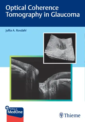 Rosdahl |  Optical Coherence Tomography in Glaucoma | eBook | Sack Fachmedien