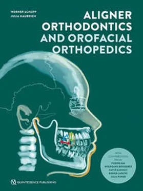 Schupp / Haubrich |  Aligner Orthodontics and Orofacial Orthopedics | Buch |  Sack Fachmedien