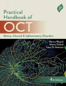 Rispoli / Gilardi / Di Antonio |  Practical Handbook of OCT | Buch |  Sack Fachmedien