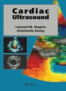 Shapiro / Kenny |  Cardiac Ultrasound | Buch |  Sack Fachmedien