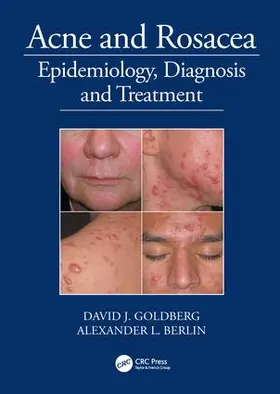 Goldberg / Berlin |  Acne and Rosacea | Buch |  Sack Fachmedien