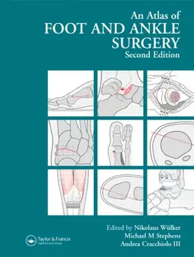 Wülker / Stephens / Cracchiolo |  Atlas Foot and Ankle Surgery | Buch |  Sack Fachmedien