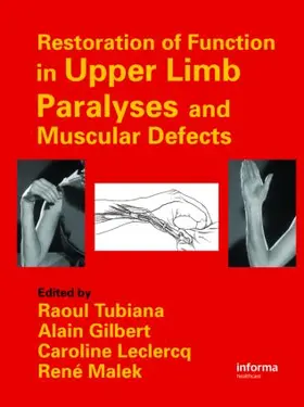 Tubiana / Gilbert / Leclercq |  Restoration of Function in Upper Limb Paralyses and Muscular Defects | Buch |  Sack Fachmedien