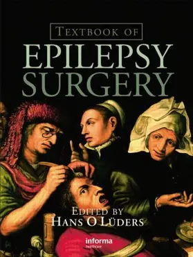 Luders |  Textbook of Epilepsy Surgery | Buch |  Sack Fachmedien