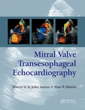 St. John Sutton / Maniet |  Mitral Valve Transesophageal Echocardiography | Buch |  Sack Fachmedien