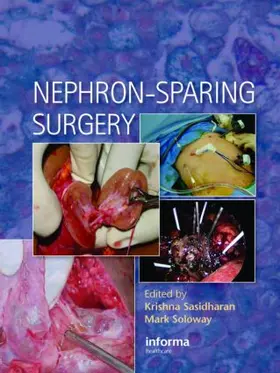 Sasidharan / Soloway |  Nephron-Sparing Surgery | Buch |  Sack Fachmedien