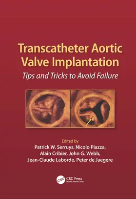 Serruys / Piazza / Cribier | Transcatheter Aortic Valve Implantation | Buch | 978-1-84184-689-7 | sack.de