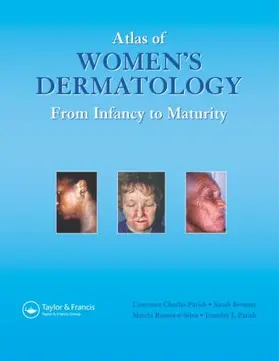 Parish MD / Brenner / Ramos e Silva |  Atlas of Women's Dermatology | Buch |  Sack Fachmedien