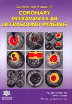 Schoenhagen / Nissen | An Atlas and Manual of Coronary Intravascular Ultrasound Imaging | Buch | 978-1-84214-274-5 | sack.de