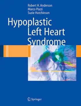Anderson / Pozzi / Hutchinson |  Hypoplastic Left Heart Syndrome | eBook | Sack Fachmedien