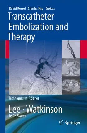 Kessel / Ray |  Transcatheter Embolization and Therapy | Buch |  Sack Fachmedien