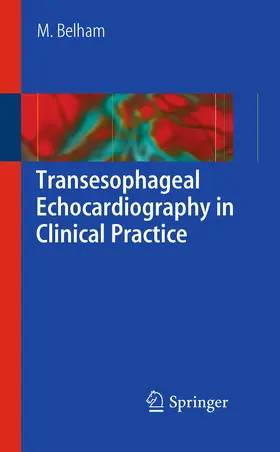 Belham | Transesophageal Echocardiography in Clinical Practice | E-Book | sack.de