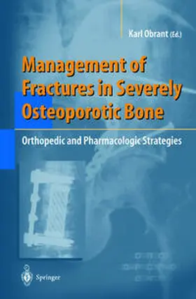 Obrant |  Management of Fractures in Severely Osteoporotic Bone | Buch |  Sack Fachmedien