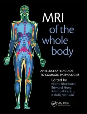 Bhuskute / Hoey / Lakkaraju |  MRI of the Whole Body | Buch |  Sack Fachmedien