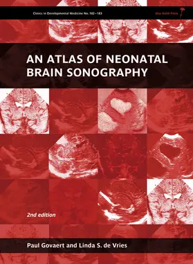 Govaert / de Vries |  An Atlas of Neonatal Brain Sonography | Buch |  Sack Fachmedien