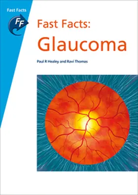 Healey / Thomas |  Fast Facts: Glaucoma | Buch |  Sack Fachmedien