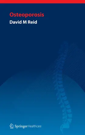 Reid |  Handbook of Osteoporosis | Buch |  Sack Fachmedien