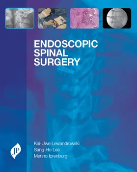 Lewandrowski / Lee / Iprenburg |  Endoscopic Spinal Surgery | Buch |  Sack Fachmedien