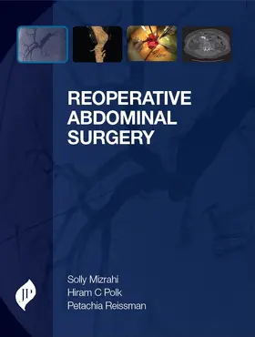 Mizrahi |  Reoperative Abdominal Surgery | Buch |  Sack Fachmedien