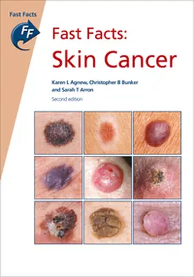 Agnew / Bunker / Arron |  Fast Facts: Skin Cancer | Buch |  Sack Fachmedien