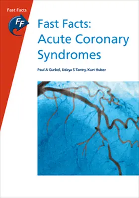 Gurbel / Tantry / Huber |  Fast Facts: Acute Coronary Syndromes | Buch |  Sack Fachmedien