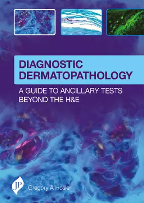 Hosler |  Diagnostic Dermatopathology | Buch |  Sack Fachmedien