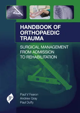 Fearon / Gray / Duffy |  Handbook of Orthopaedic Trauma | Buch |  Sack Fachmedien