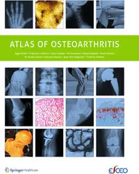 Arden / Hayashi / Blanco |  Atlas of Osteoarthritis | Buch |  Sack Fachmedien