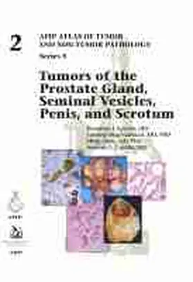 Cubilla / Epstein / Magi-Galluzzi |  Tumors of the Prostate Gland, Seminal Vesicles, Penis, and Scrotum | Buch |  Sack Fachmedien