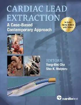 Mulpuru / Cha |  Cardiac Lead Extraction: A Case-Based Contemporary Approach | eBook | Sack Fachmedien
