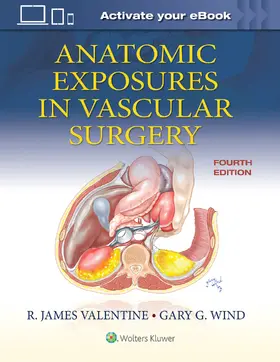 Valentine / Wind |  Anatomic Exposures in Vascular Surgery | Buch |  Sack Fachmedien