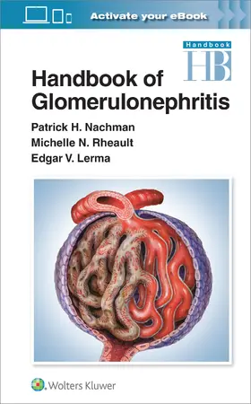 Lerma / Nachman / Rheault |  Handbook of Glomerulonephritis | Buch |  Sack Fachmedien