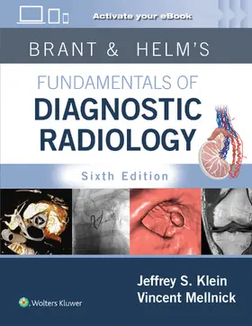 Klein / Mellnick |  Brant & Helms' Fundamentals of Diagnostic Radiology: Print + eBook with Multimedia | Buch |  Sack Fachmedien