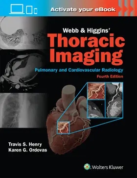 Henry / ORDOVAS |  Webb & Higgins Thoracic Imaging: Print + eBook with Multimedia | Buch |  Sack Fachmedien