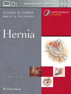JONES / Matthews | Master Techniques in Surgery: Hernia: Print + eBook with Multimedia | Buch | 978-1-9752-2229-1 | www2.sack.de