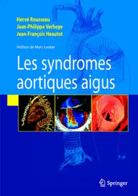 Rousseau / Verhoye / Heautot |  Syndromes aortiques aigus | eBook | Sack Fachmedien