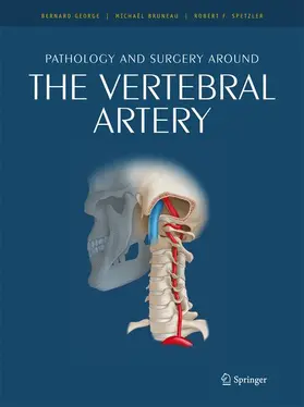 George / Bruneau |  Pathology and surgery around the vertebral artery | Buch |  Sack Fachmedien