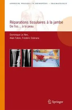 Le Nen / Fabre / Dubrana |  Réparations tissulaires à la jambe | Buch |  Sack Fachmedien
