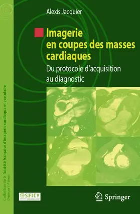 Jacquier |  Imagerie en coupes des masses cardiaques | Buch |  Sack Fachmedien