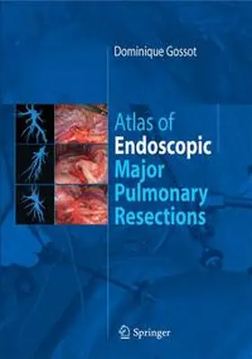Gossot | Atlas of endoscopic major pulmonary resections | Buch | 978-2-287-99776-1 | www2.sack.de